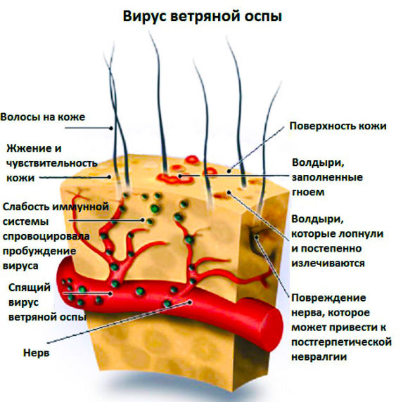 Схема вируса оспы