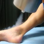Криотерапия ног