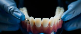 Протезирование зубов: как вернуть улыбке комфорт и уверенность